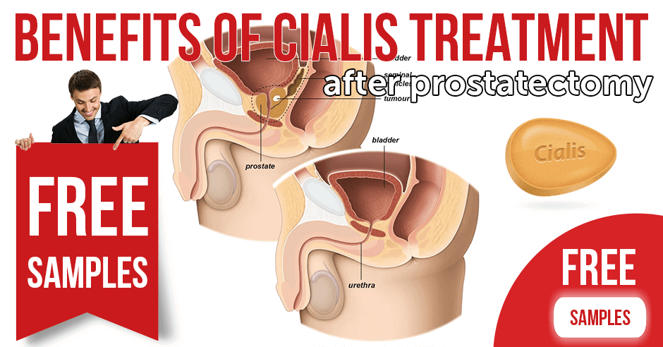 Benefits of Cialis Treatment After Prostatectomy